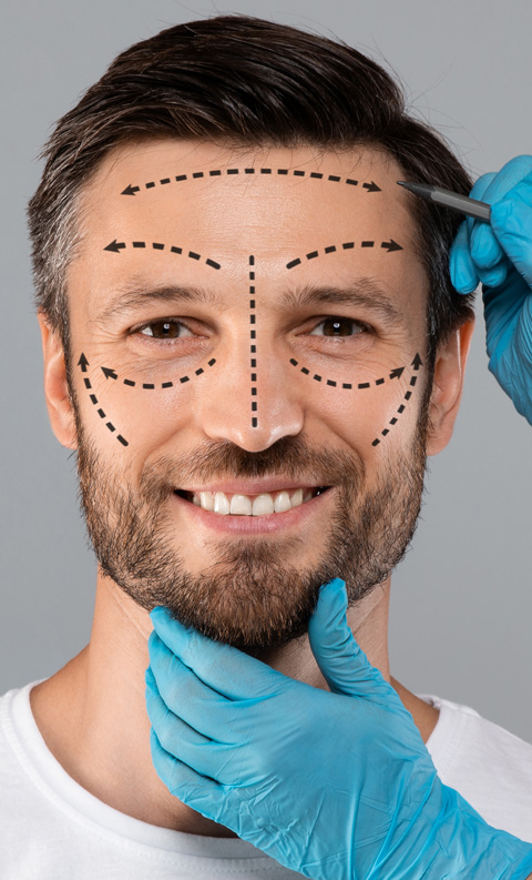 stock photo of Plastic surgeon applying marks with pencil on handsome man face before surgery