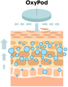 The oxygenation process image